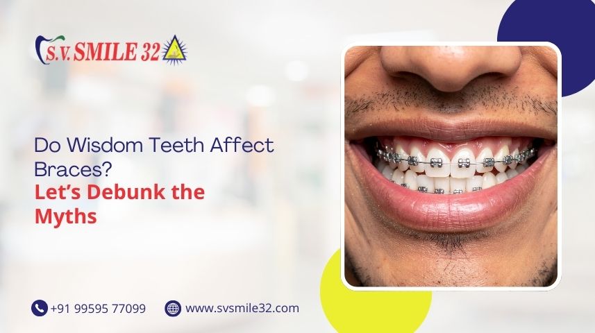Do Wisdom Teeth Affect Braces? Let’s Debunk the Myths