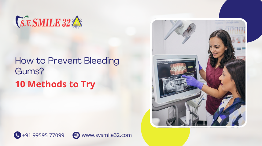 How To Prevent Bleeding Gums? 10 Methods To Try