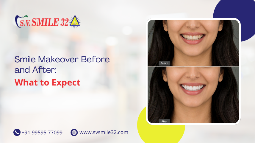 Smile Makeover Before and After: What to Expect