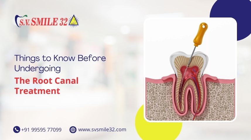 Things to Know Before Undergoing The Root Canal Treatment